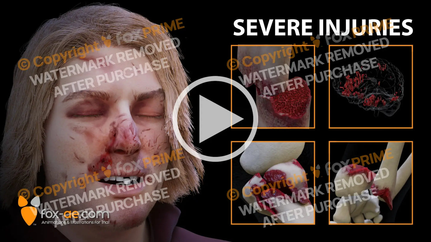 CUSTOM INJURY (GENERAL) Laceration / Animation