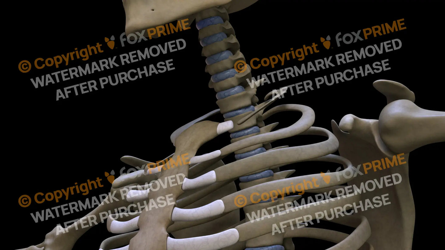 Disc T1 (Left) Still Shot