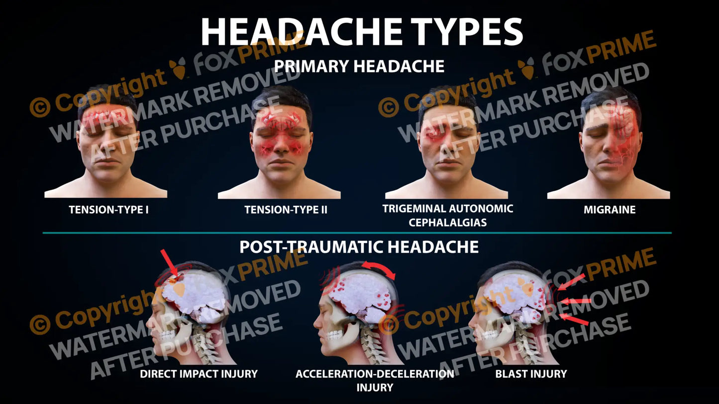 Headache Types Still Shot