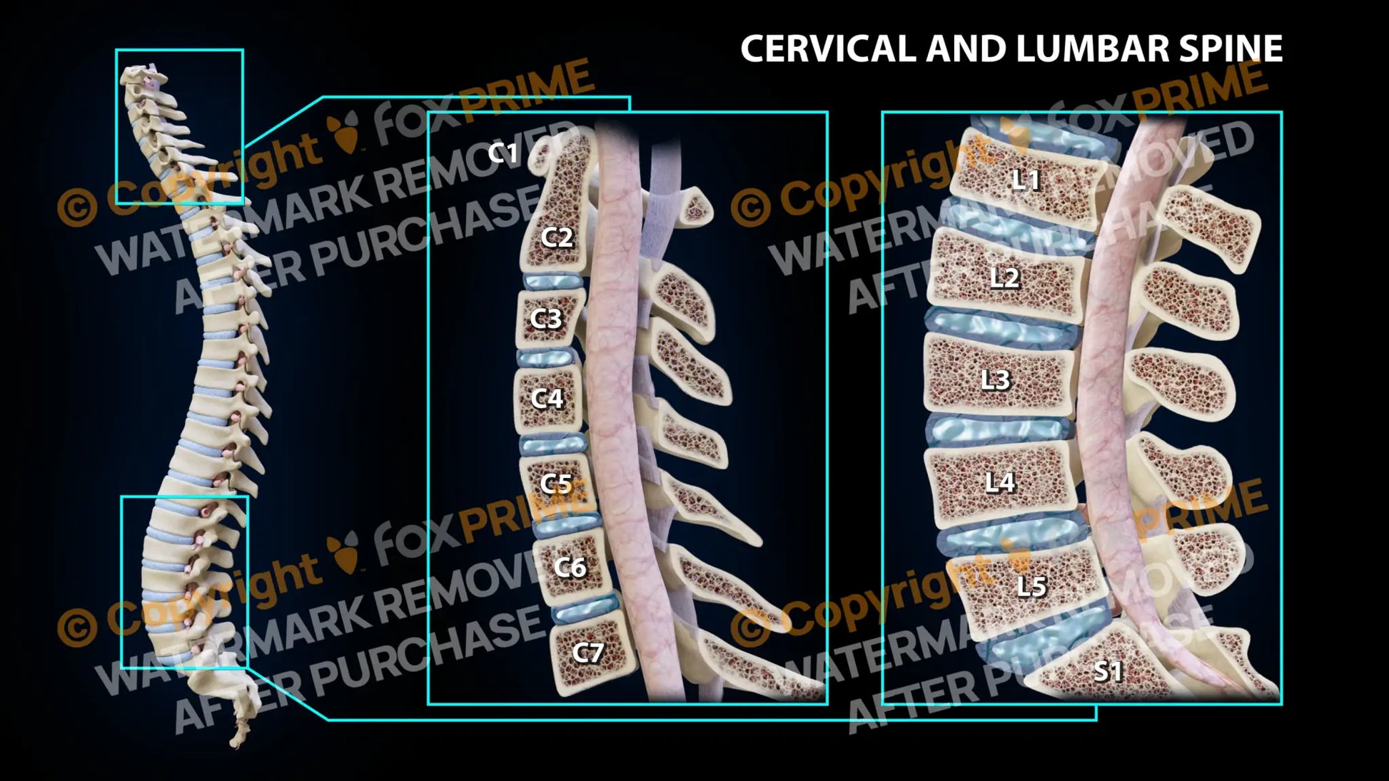 Cervical and Lumbar Spine Still Shot