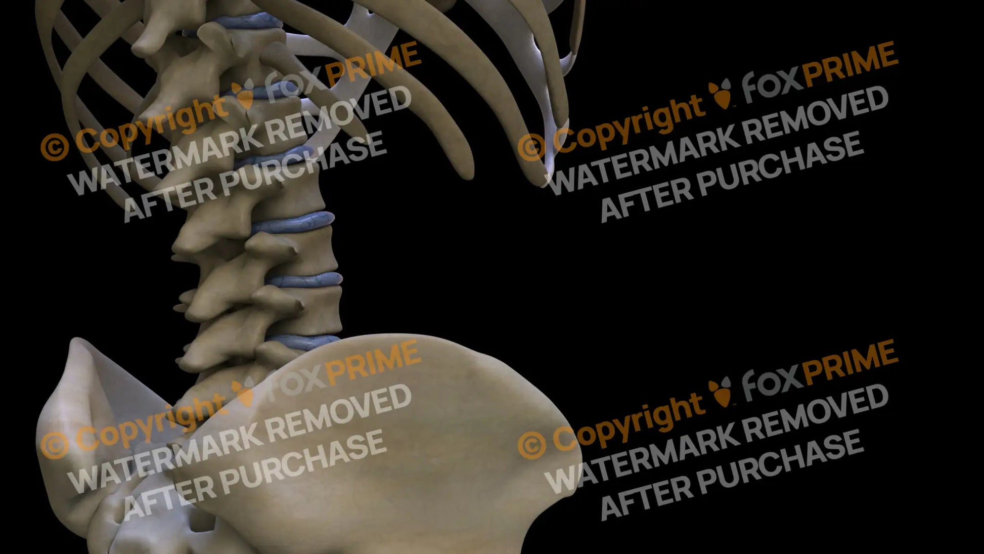 Disc L1-L4 (Right) Still Shot