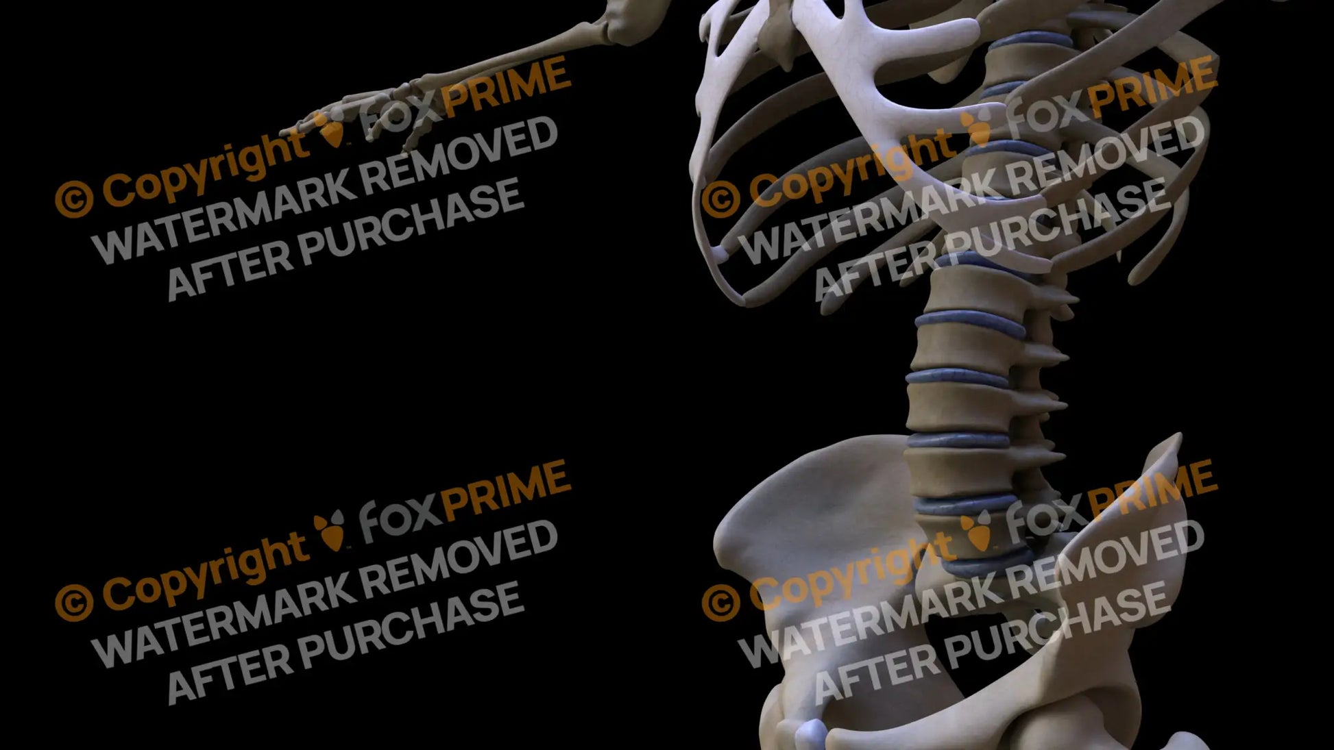 Disc L1-L5 (Left) Still Shot