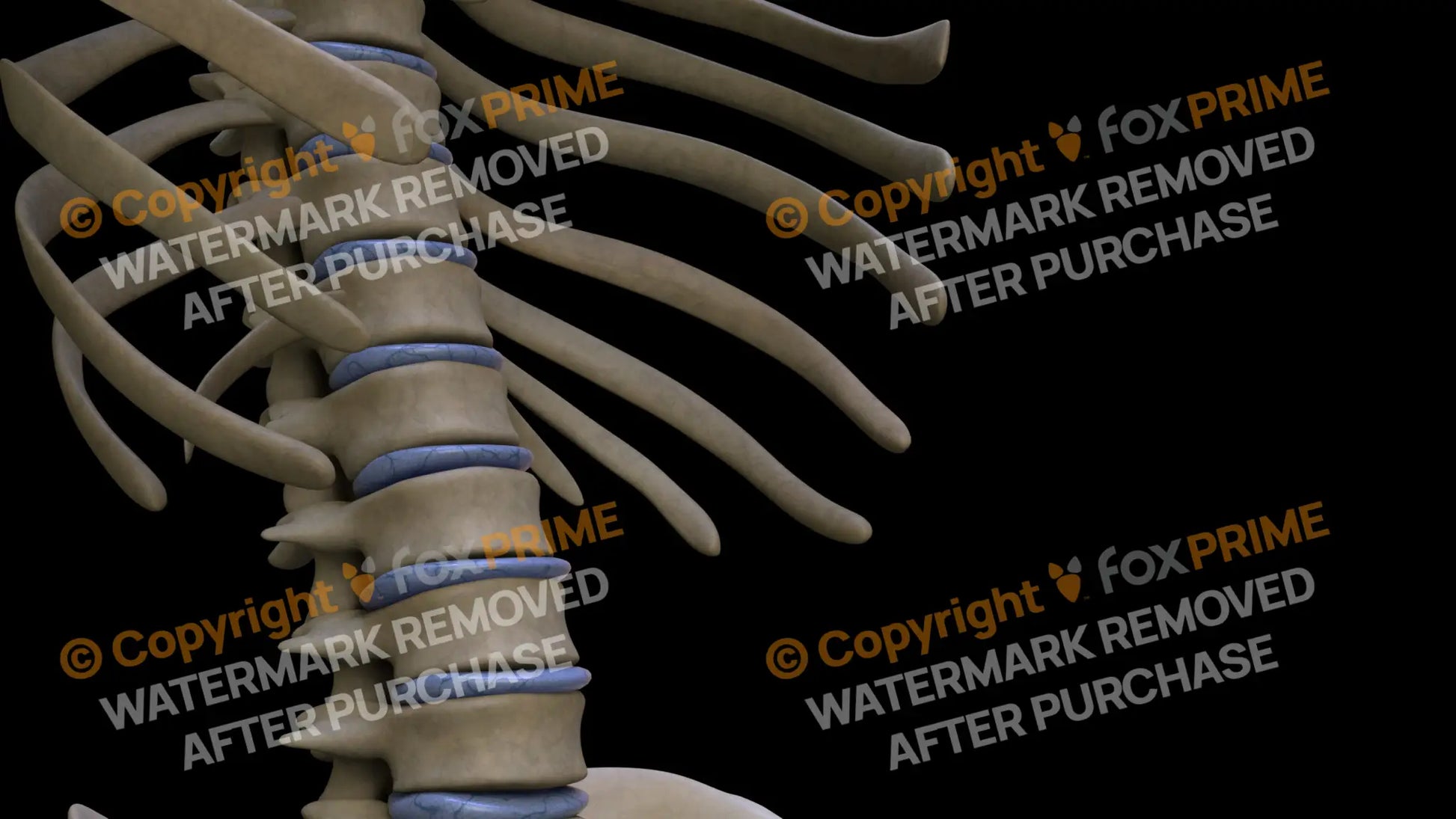 Disc T11 (Right) Still Shot