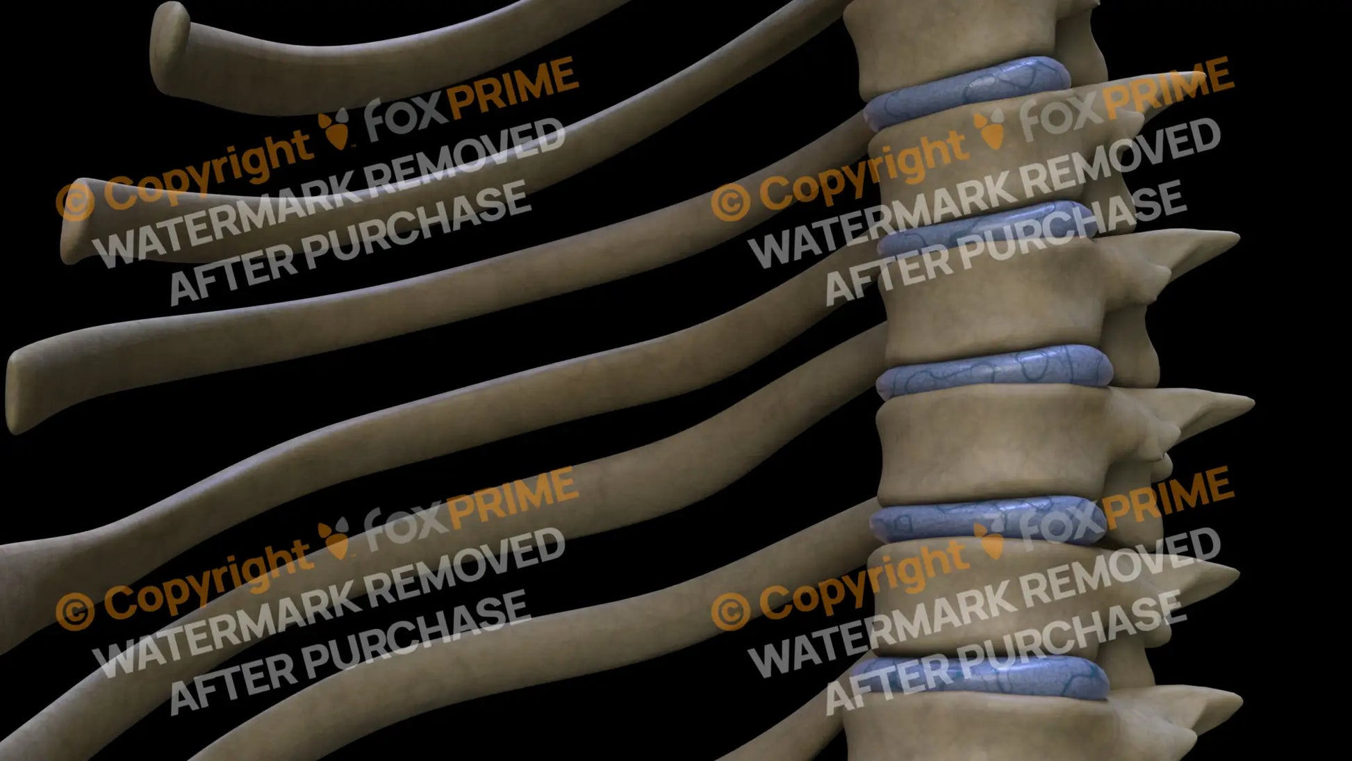 Disc T6 (Left) Still Shot