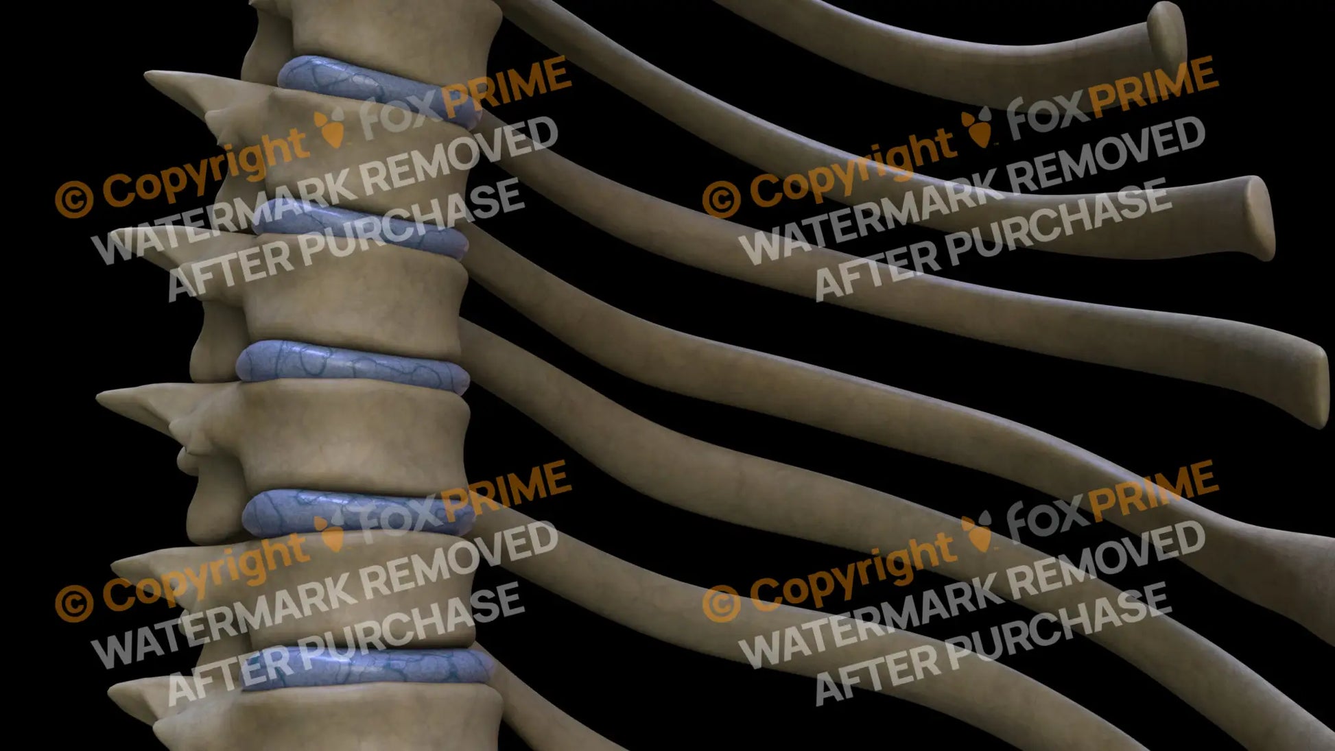 Disc T6 (Right) Still Shot