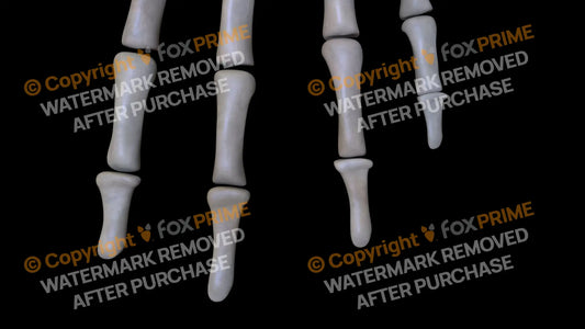 Distal Phalange 02-05 (Left) Still Shot