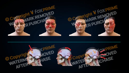 Headache Types (No Text) Still Shot