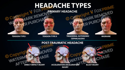 Headache Types Still Shot