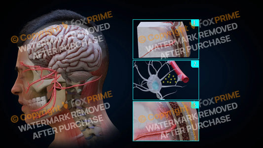 Mechanism of Headache (No Text) Still Shot