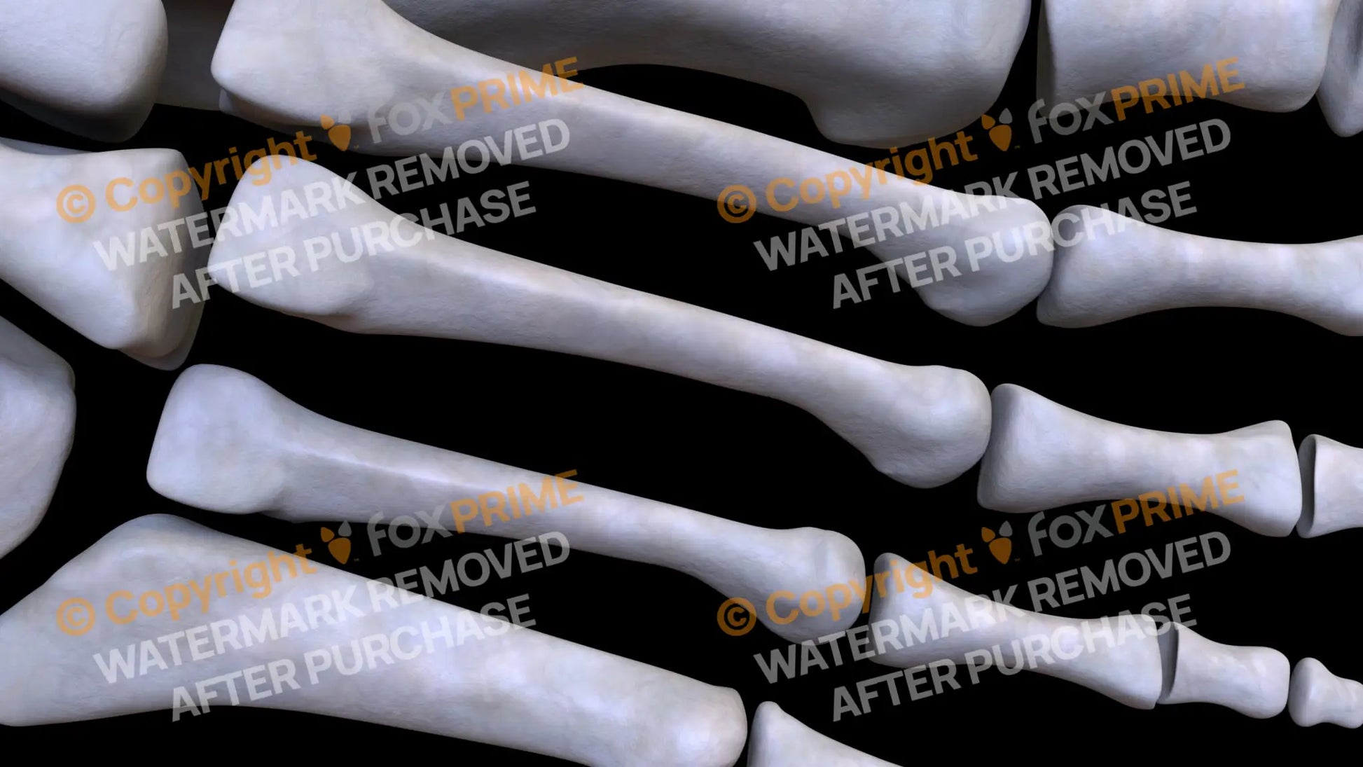 Metarsal 03 (Right) Still Shot