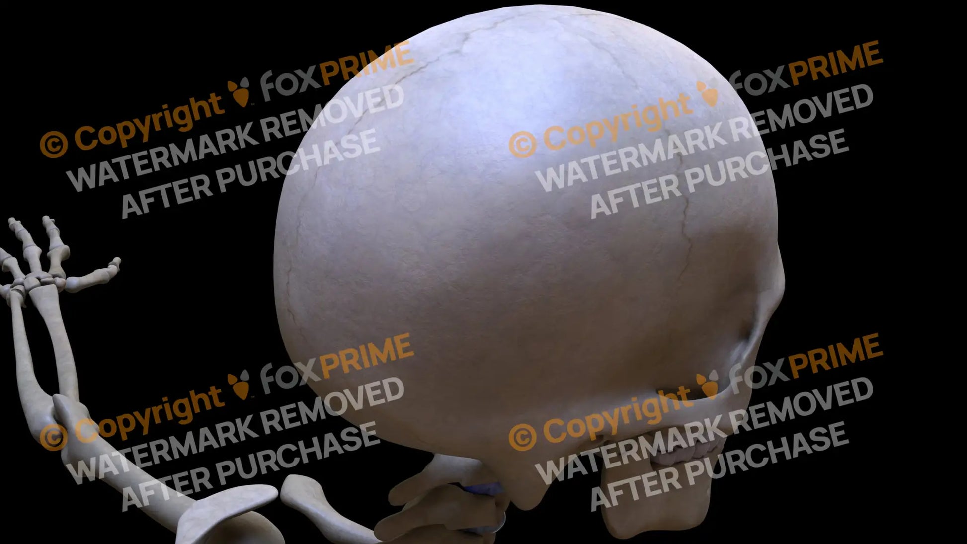 Parietal Bone 1 (Right) Still Shot