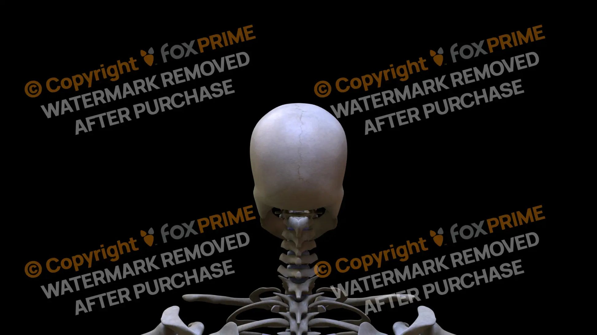 Parietal Bone 3 Still Shot
