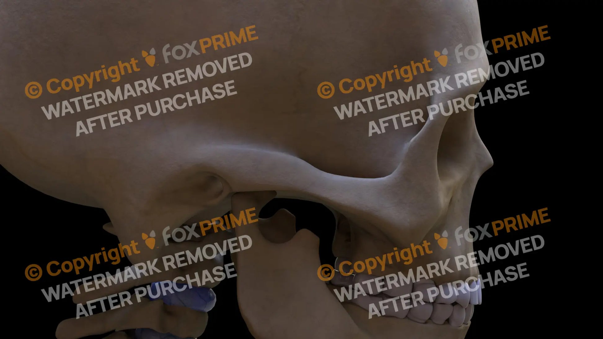 Temporal Bone 1 (Right) Still Shot
