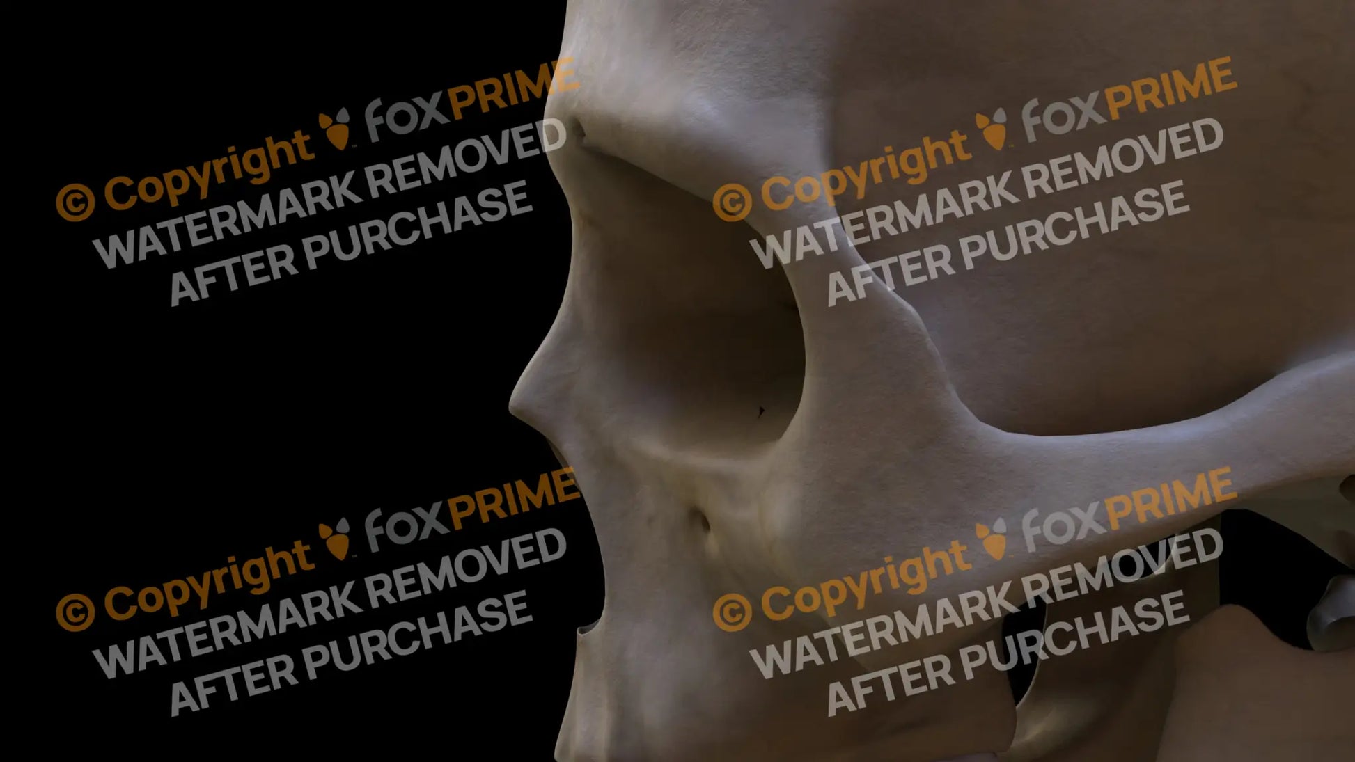 Temporal Bone 2 (Left) Still Shot